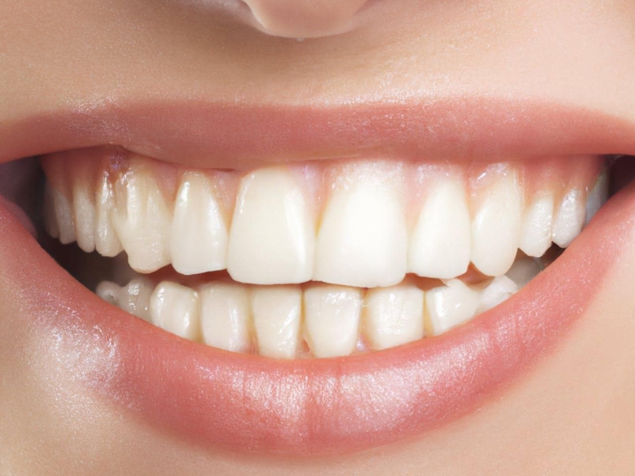 5 Tipps zur Verbesserung der Ästhetik Ihres Lächelns