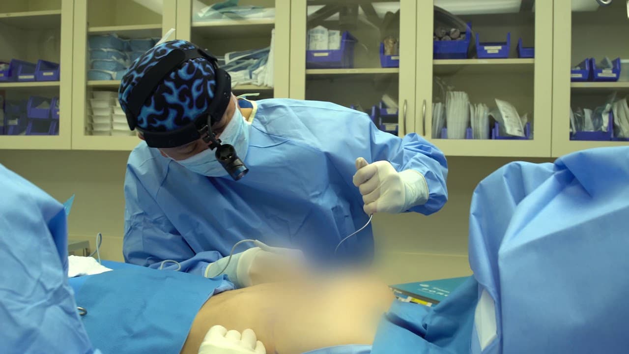 Fettabsaugung und Körperformung: Plastische Chirurgie Bochum im Fokus