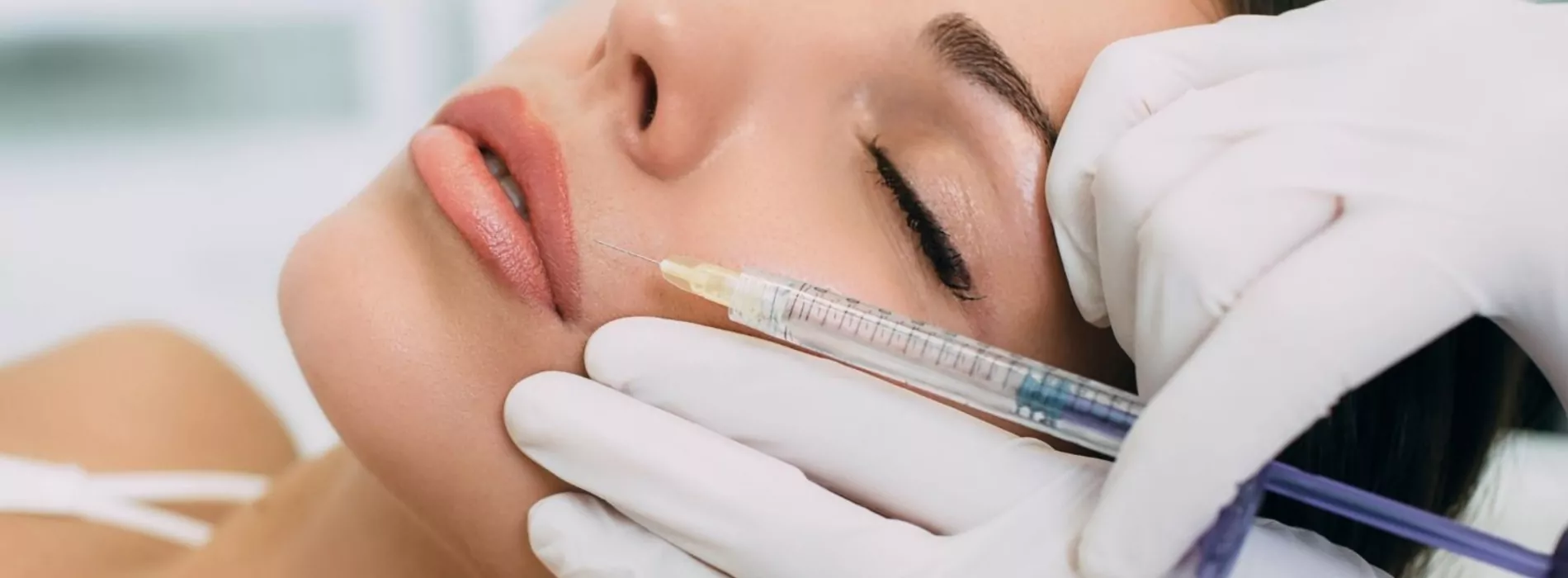 Erhöhen Sie Ihre Schönheit mit Lippen Aufspritzen Nürnberg und Hautstraffung bei MY AESTHETICS